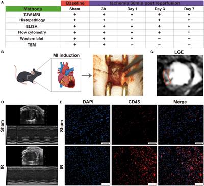 Characterization of early myocardial inflammation in ischemia-reperfusion injury